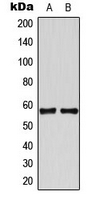 Western blot analysis of TBX22 expression in HeLa (A); Jurkat (B) whole cell lysates.