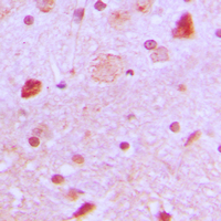 Immunohistochemical analysis of TBX22 staining in human brain formalin fixed paraffin embedded tissue section. The section was pre-treated using heat mediated antigen retrieval with sodium citrate buffer (pH 6.0). The section was then incubated with the antibody at room temperature and detected using an HRP conjugated compact polymer system. DAB was used as the chromogen. The section was then counterstained with haematoxylin and mounted with DPX.