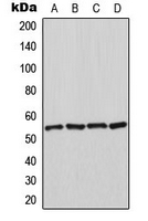 Western blot analysis of HSPA14 expression in K562 (A); HeLa (B); NIH3T3 (C); rat kidney (D) whole cell lysates.