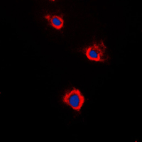 Immunofluorescent analysis of Adenylate Cyclase 5/6 staining in Raw264.7 cells. Formalin-fixed cells were permeabilized with 0.1% Triton X-100 in TBS for 5-10 minutes and blocked with 3% BSA-PBS for 30 minutes at room temperature. Cells were probed with the primary antibody in 3% BSA-PBS and incubated overnight at 4 C in a humidified chamber. Cells were washed with PBST and incubated with a DyLight 594-conjugated secondary antibody (red) in PBS at room temperature in the dark. DAPI was used to stain the cell nuclei (blue).
