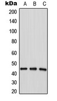 Western blot analysis of LPAAT delta expression in HepG2 (A); MDAMB435 (B); MCF7 (C) whole cell lysates.