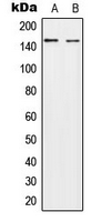 Western blot analysis of HECW2 expression in A549 (A); NIH3T3 (B) whole cell lysates.