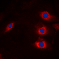 Immunofluorescent analysis of HECW2 staining in A549 cells. Formalin-fixed cells were permeabilized with 0.1% Triton X-100 in TBS for 5-10 minutes and blocked with 3% BSA-PBS for 30 minutes at room temperature. Cells were probed with the primary antibody in 3% BSA-PBS and incubated overnight at 4 C in a humidified chamber. Cells were washed with PBST and incubated with a DyLight 594-conjugated secondary antibody (red) in PBS at room temperature in the dark. DAPI was used to stain the cell nuclei (blue).