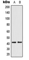 Western blot analysis of KCNK15 expression in JEG3 (A); HeLa (B) whole cell lysates.