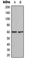 Western blot analysis of CCDC102B expression in HepG2 (A); NIH3T3 (B) whole cell lysates.