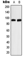 Western blot analysis of ITPKC expression in HeLa (A); RT4 (B) whole cell lysates.