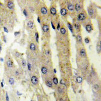 Immunohistochemical analysis of ACAD10 staining in human liver formalin fixed paraffin embedded tissue section. The section was pre-treated using heat mediated antigen retrieval with sodium citrate buffer (pH 6.0). The section was then incubated with the antibody at room temperature and detected using an HRP conjugated compact polymer system. DAB was used as the chromogen. The section was then counterstained with haematoxylin and mounted with DPX.