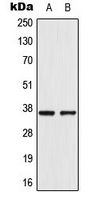 Western blot analysis of AKR1CL2 expression in VEC (A); A549 (B) whole cell lysates.