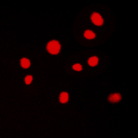 Immunofluorescent analysis of ATRIP staining in MCF7 cells. Formalin-fixed cells were permeabilized with 0.1% Triton X-100 in TBS for 5-10 minutes and blocked with 3% BSA-PBS for 30 minutes at room temperature. Cells were probed with the primary antibody in 3% BSA-PBS and incubated overnight at 4 C in a humidified chamber. Cells were washed with PBST and incubated with a DyLight 594-conjugated secondary antibody (red) in PBS at room temperature in the dark. DAPI was used to stain the cell nuclei (blue).
