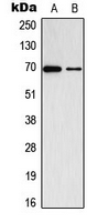 Western blot analysis of ADCK2 expression in K562 (A); VEC (B) whole cell lysates.