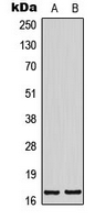 Western blot analysis of BTF3L4 expression in K562 (A); NIH3T3 (B) whole cell lysates.