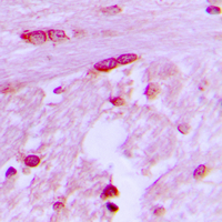 Immunohistochemical analysis of BTF3L4 staining in human brain formalin fixed paraffin embedded tissue section. The section was pre-treated using heat mediated antigen retrieval with sodium citrate buffer (pH 6.0). The section was then incubated with the antibody at room temperature and detected using an HRP conjugated compact polymer system. DAB was used as the chromogen. The section was then counterstained with haematoxylin and mounted with DPX.