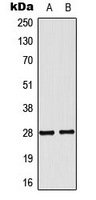 Western blot analysis of NKX2-6 expression in MCF7 (A); COLO205 (B) whole cell lysates.