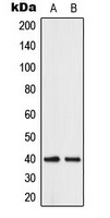 Western blot analysis of ABHD12B expression in human brain (A); K562 (B) whole cell lysates.