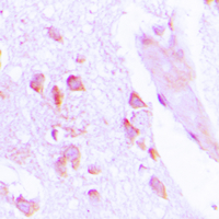 Immunohistochemical analysis of ABHD12B staining in human brain formalin fixed paraffin embedded tissue section. The section was pre-treated using heat mediated antigen retrieval with sodium citrate buffer (pH 6.0). The section was then incubated with the antibody at room temperature and detected using an HRP conjugated compact polymer system. DAB was used as the chromogen. The section was then counterstained with haematoxylin and mounted with DPX.