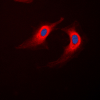 Immunofluorescent analysis of ABHD12B staining in K562 cells. Formalin-fixed cells were permeabilized with 0.1% Triton X-100 in TBS for 5-10 minutes and blocked with 3% BSA-PBS for 30 minutes at room temperature. Cells were probed with the primary antibody in 3% BSA-PBS and incubated overnight at 4 C in a humidified chamber. Cells were washed with PBST and incubated with a DyLight 594-conjugated secondary antibody (red) in PBS at room temperature in the dark. DAPI was used to stain the cell nuclei (blue).