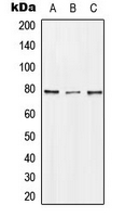 Western blot analysis of DQX1 expression in Jurkat (A); mouse kidney (B); rat kidney (C) whole cell lysates.