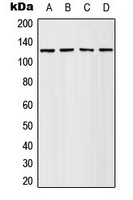 Western blot analysis of Adenylate Cyclase 4 expression in HeLa (A); Jurkat (B); SP2/0 (C); PC12 (D) whole cell lysates.