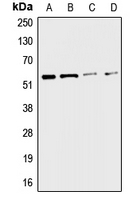 Western blot analysis of CHRNA3 expression in A549 (A); HepG2 (B); mouse liver (C); rat kidney (D) whole cell lysates.