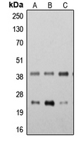 Western blot analysis of STING expression in K562 (A); THP1 (B); HeLa (C) whole cell lysates.