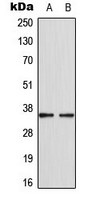 Western blot analysis of CDKL4 expression in MCF7 (A); HepG2 (B) whole cell lysates.