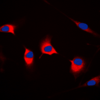 Immunofluorescent analysis of CDKL4 staining in MCF7 cells. Formalin-fixed cells were permeabilized with 0.1% Triton X-100 in TBS for 5-10 minutes and blocked with 3% BSA-PBS for 30 minutes at room temperature. Cells were probed with the primary antibody in 3% BSA-PBS and incubated overnight at 4 C in a humidified chamber. Cells were washed with PBST and incubated with a DyLight 594-conjugated secondary antibody (red) in PBS at room temperature in the dark. DAPI was used to stain the cell nuclei (blue).