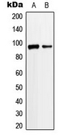 Western blot analysis of ANKRD20A3 expression in Jurkat (A); K562 (B) whole cell lysates.