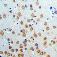 Immunohistochemical analysis of ANKRD20A3 staining in human brain formalin fixed paraffin embedded tissue section. The section was pre-treated using heat mediated antigen retrieval with sodium citrate buffer (pH 6.0). The section was then incubated with the antibody at room temperature and detected using an HRP conjugated compact polymer system. DAB was used as the chromogen. The section was then counterstained with haematoxylin and mounted with DPX.