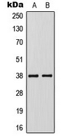 Western blot analysis of KLF1/5/7 expression in Jurkat (A); VEC (B) whole cell lysates.