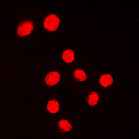Immunofluorescent analysis of KLF1/5/7 staining in Jurkat cells. Formalin-fixed cells were permeabilized with 0.1% Triton X-100 in TBS for 5-10 minutes and blocked with 3% BSA-PBS for 30 minutes at room temperature. Cells were probed with the primary antibody in 3% BSA-PBS and incubated overnight at 4 C in a humidified chamber. Cells were washed with PBST and incubated with a DyLight 594-conjugated secondary antibody (red) in PBS at room temperature in the dark. DAPI was used to stain the cell nuclei (blue).