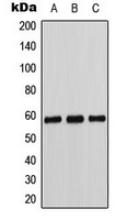 Western blot analysis of Cytochrome P450 11B1/2 expression in K562 (A); Caki1 (B); MCF7 (C) whole cell lysates.