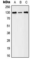 Western blot analysis of EPHB1/2 (pY594/604) expression in A431 (A); HeLa (B); NIH3T3 (C) whole cell lysates.