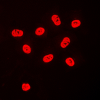 Immunofluorescent analysis of SP3/4 staining in HeLa cells. Formalin-fixed cells were permeabilized with 0.1% Triton X-100 in TBS for 5-10 minutes and blocked with 3% BSA-PBS for 30 minutes at room temperature. Cells were probed with the primary antibody in 3% BSA-PBS and incubated overnight at 4 C in a humidified chamber. Cells were washed with PBST and incubated with a DyLight 594-conjugated secondary antibody (red) in PBS at room temperature in the dark. DAPI was used to stain the cell nuclei (blue).