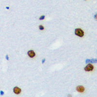 Immunohistochemical analysis of hnRNP LL staining in human brain formalin fixed paraffin embedded tissue section. The section was pre-treated using heat mediated antigen retrieval with sodium citrate buffer (pH 6.0). The section was then incubated with the antibody at room temperature and detected using an HRP conjugated compact polymer system. DAB was used as the chromogen. The section was then counterstained with haematoxylin and mounted with DPX.