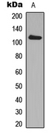 Western blot analysis of ADAM19 expression in MCF7 (A) whole cell lysates.