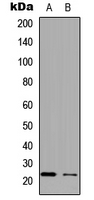 Western blot analysis of APOBEC3C expression in HepG2 (A); PC12 (B) whole cell lysates.