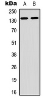 Western blot analysis of ARHGAP20 expression in A549 (A); PC12 (B) whole cell lysates.