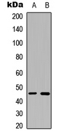 Western blot analysis of B4GALT6 expression in A549 (A); NS-1 (B) whole cell lysates.