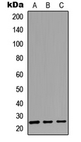 Western blot analysis of CABP2 expression in A549 (A); NS-1 (B); H9C2 (C) whole cell lysates.