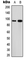 Western blot analysis of Calpain 3 expression in MCF7 (A); PC12 (B) whole cell lysates.