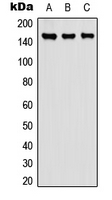 Western blot analysis of Carboxypeptidase D expression in A549 (A); NS-1 (B); PC12 (C) whole cell lysates.