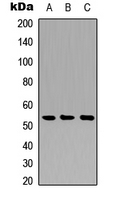 Western blot analysis of Cathepsin A 20k expression in A549 (A); NS-1 (B); PC12 (C) whole cell lysates.