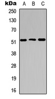 Western blot analysis of Cathepsin C LC expression in HEK293T (A); Raw264.7 (B); PC12 (C) whole cell lysates.