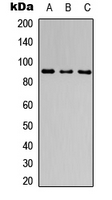 Western blot analysis of CATSPER1 expression in MCF7 (A); NS-1 (B); PC12 (C) whole cell lysates.