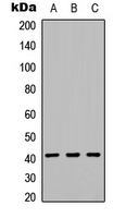 Western blot analysis of CD158f1 expression in HEK293T (A); NS-1 (B); PC12 (C) whole cell lysates.