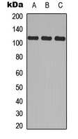 Western blot analysis of CD41 HC expression in MCF7 (A); Raw264.7 (B); PC12 (C) whole cell lysates.