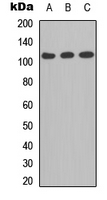 Western blot analysis of CD41 LC 1 expression in A549 (A); MCF7 (B); PC12 (C) whole cell lysates.