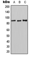 Western blot analysis of CLCN7 expression in HeLa (A); mouse liver (B); rat liver (C) whole cell lysates.