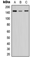 Western blot analysis of Collagen 5 alpha 2 expression in HEK293T (A); Raw264.7 (B); PC12 (C) whole cell lysates.