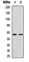 Western blot analysis of Cytochrome P450 11B2 expression in HEK293T (A); Raw264.7 (B) whole cell lysates.